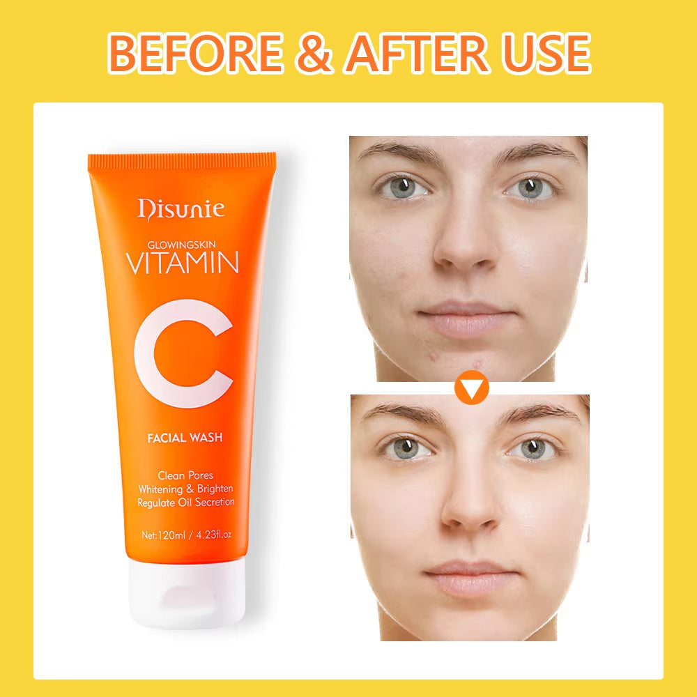 Vitamin C Amino Acid Facial Cleanser Face Glow And Cleans Whitening Brightening Oil Control Face Wash For Men Women - lotbak